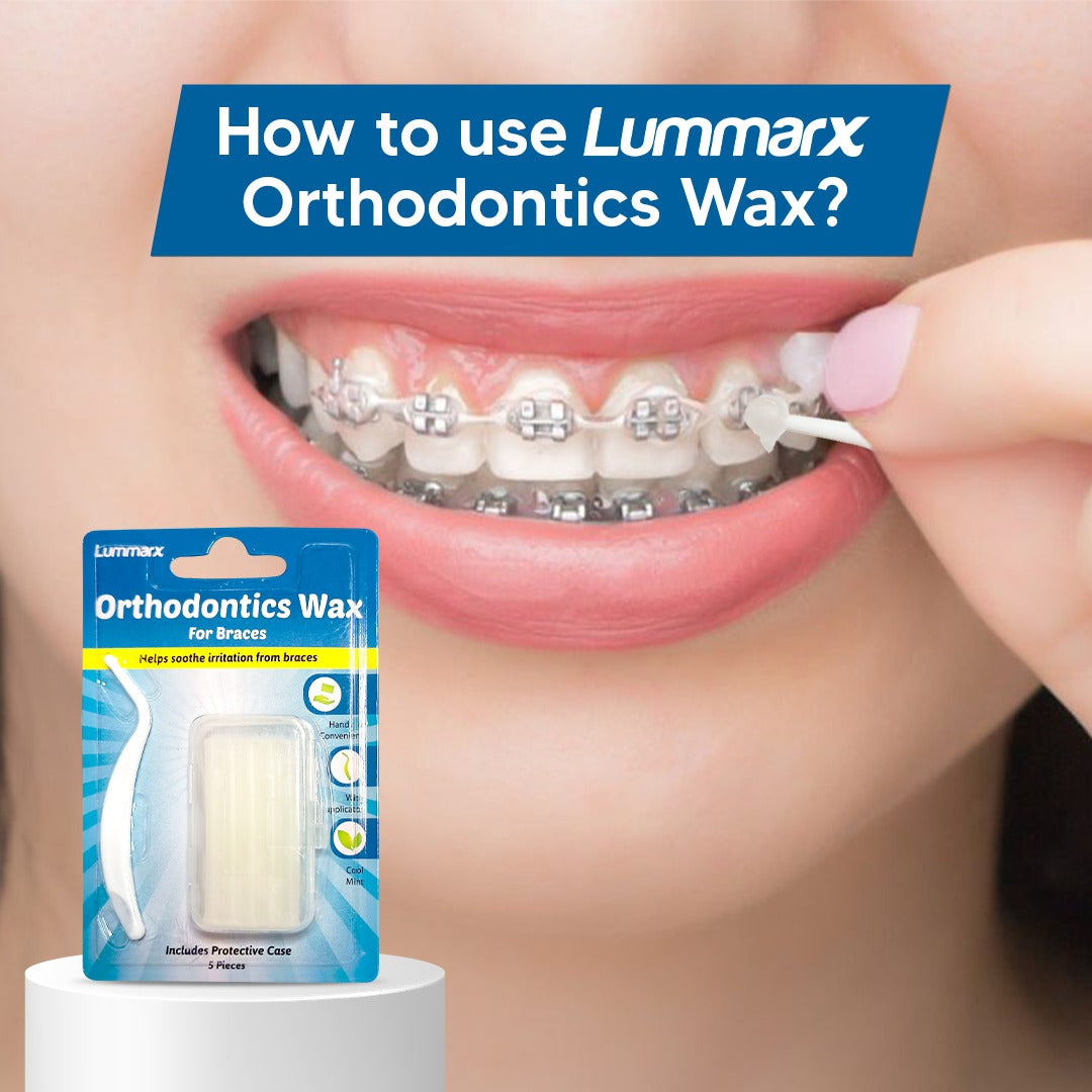 Lummarx Orthodontics Wax