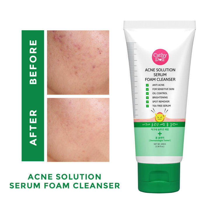 Cathy Doll Aura Whitening Serum Foam Cleanser and Acne Solution Serum Foam Cleanser 100ml